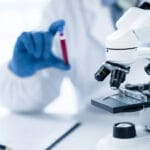 Thalassemia: Causes, Symptoms, Diagnosis and Treatment