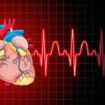 Cardiac Arrhythmias